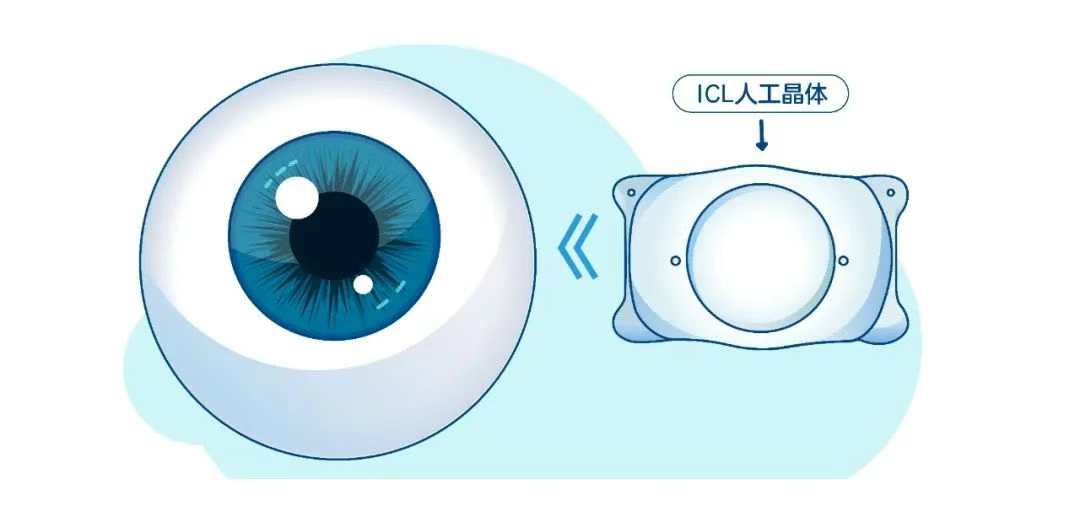 图片.png 图片.png