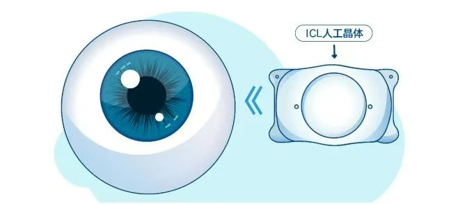 图片.png 图片.png