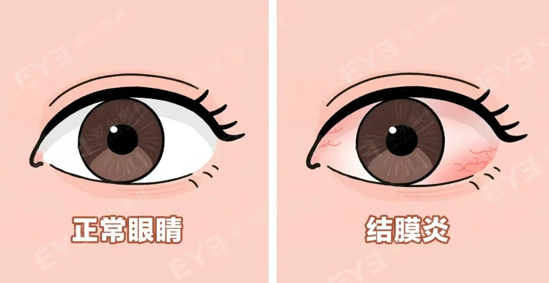 图片.png 图片.png